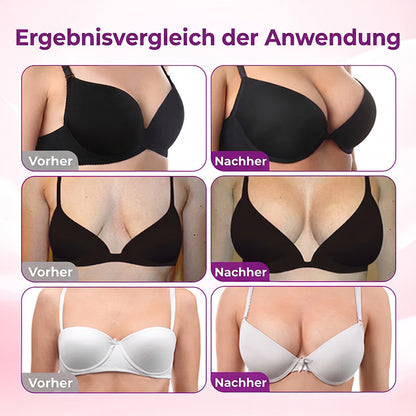 Turonu® Nano-Mikronadel-Pflaster für eine gezielte Brustpflege und ein verbessertes Hautgefühl 💎