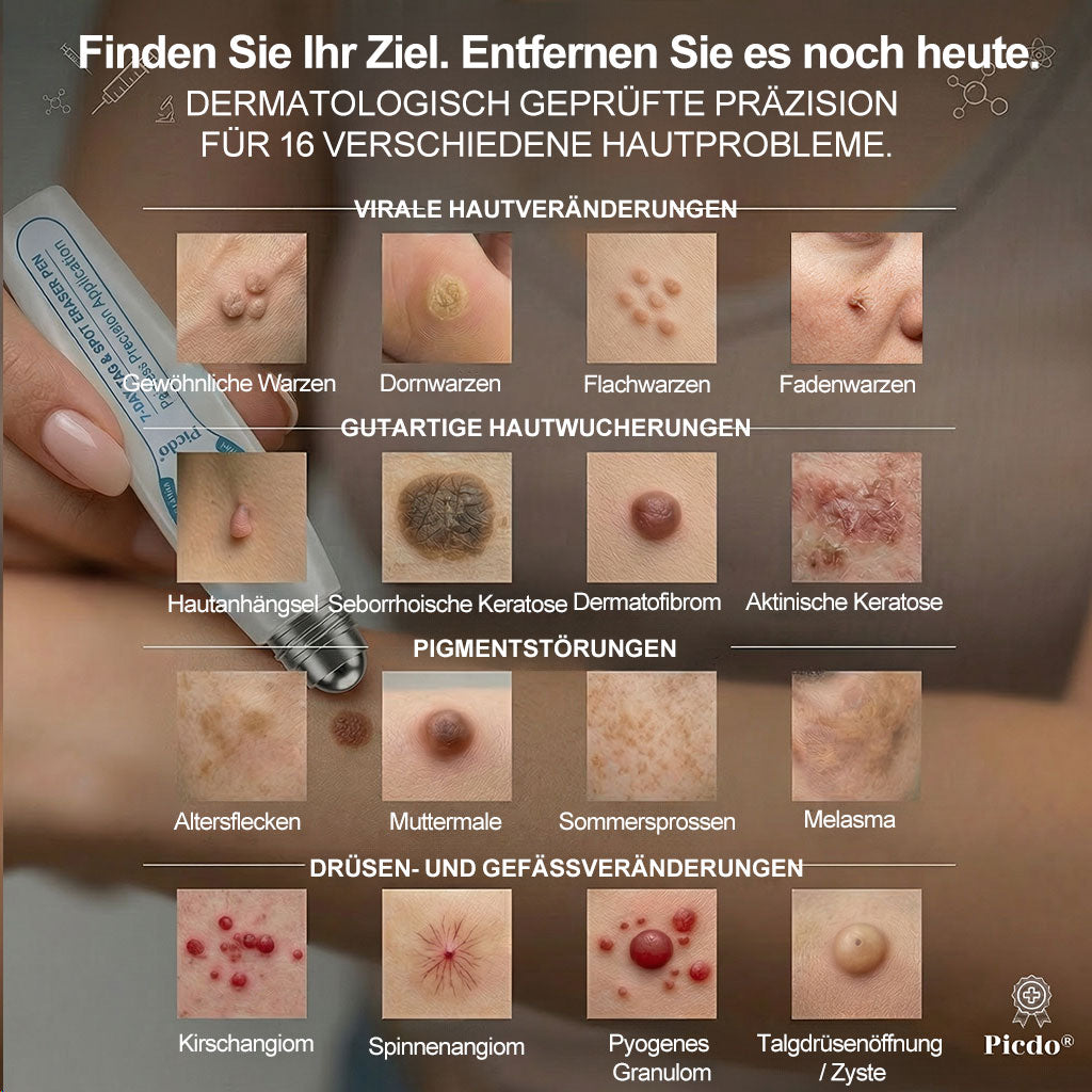 Offizieller Markenstore |✅𝑷𝑖𝒄𝐝𝐨® 7-𝑻𝒂𝒈𝒆 𝑯𝒂𝒖𝒕𝒂𝒏𝒉ä𝒏𝒈𝒔𝒆𝒍- & 𝑭𝒍𝒆𝒄𝒌𝒆𝒏𝒆𝒏𝒕𝒇𝒆𝒓𝒏𝒆𝒓(Schmerzfreier Rollerball – Keine Narbenbildung)🛡️
