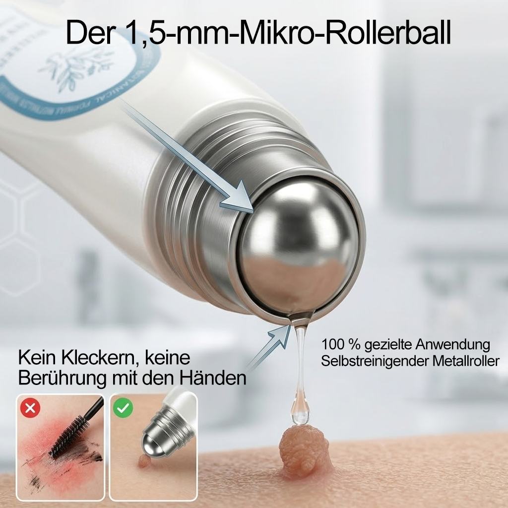Offizieller Markenstore |✅𝑷𝑖𝒄𝐝𝐨® 7-𝑻𝒂𝒈𝒆 𝑯𝒂𝒖𝒕𝒂𝒏𝒉ä𝒏𝒈𝒔𝒆𝒍- & 𝑭𝒍𝒆𝒄𝒌𝒆𝒏𝒆𝒏𝒕𝒇𝒆𝒓𝒏𝒆𝒓(Schmerzfreier Rollerball – Keine Narbenbildung)🛡️
